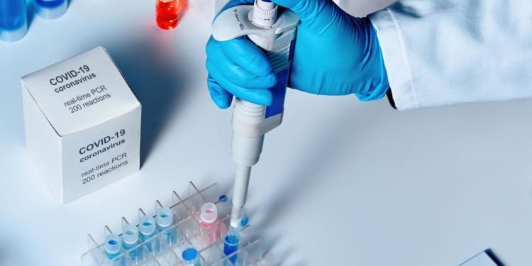 الحرب في زمن الكورونا .. بين سباق شرعي، وقرصنة علمية