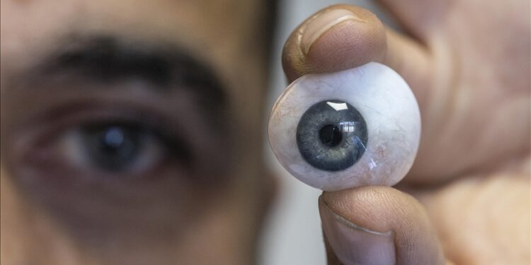 أنقرة.. تركي يبدع في صنع العيون الاصطناعية