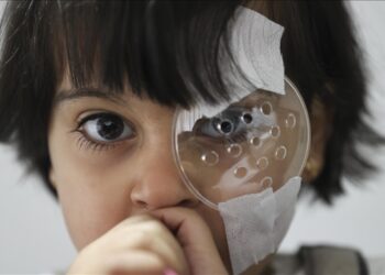 تركيا.. طفلة سورية تبصر النور عقب عملية جراحية ناجحة